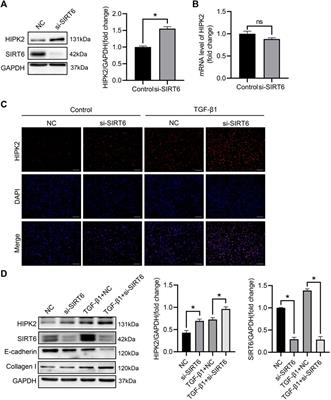 SIRT6 overexpression retards renal interstitial fibrosis through targeting HIPK2 in chronic kidney disease